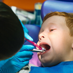 child getting tooth colored fillings at dentist 